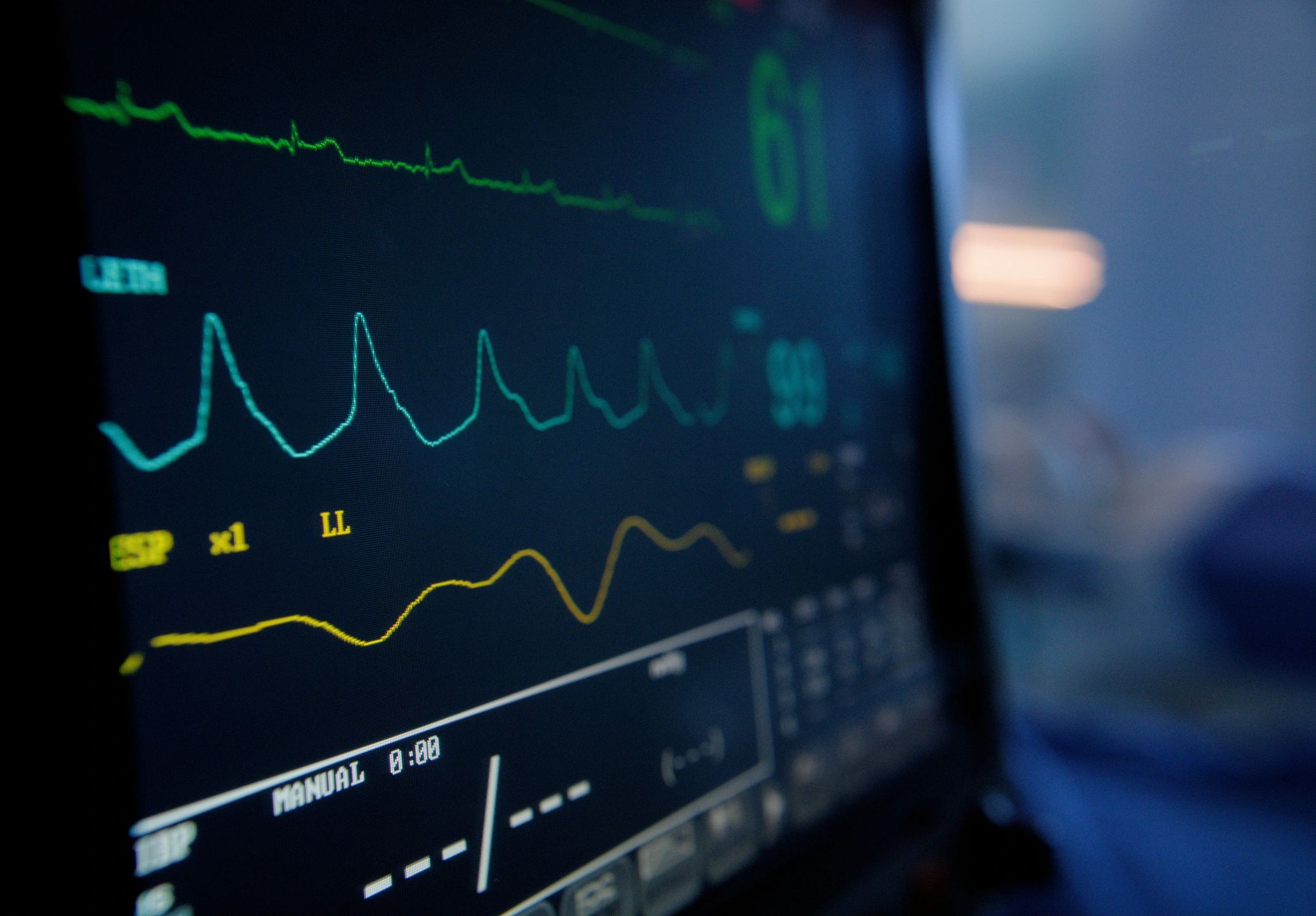 Close-up of a vital signs monitor showing an ECG waveform